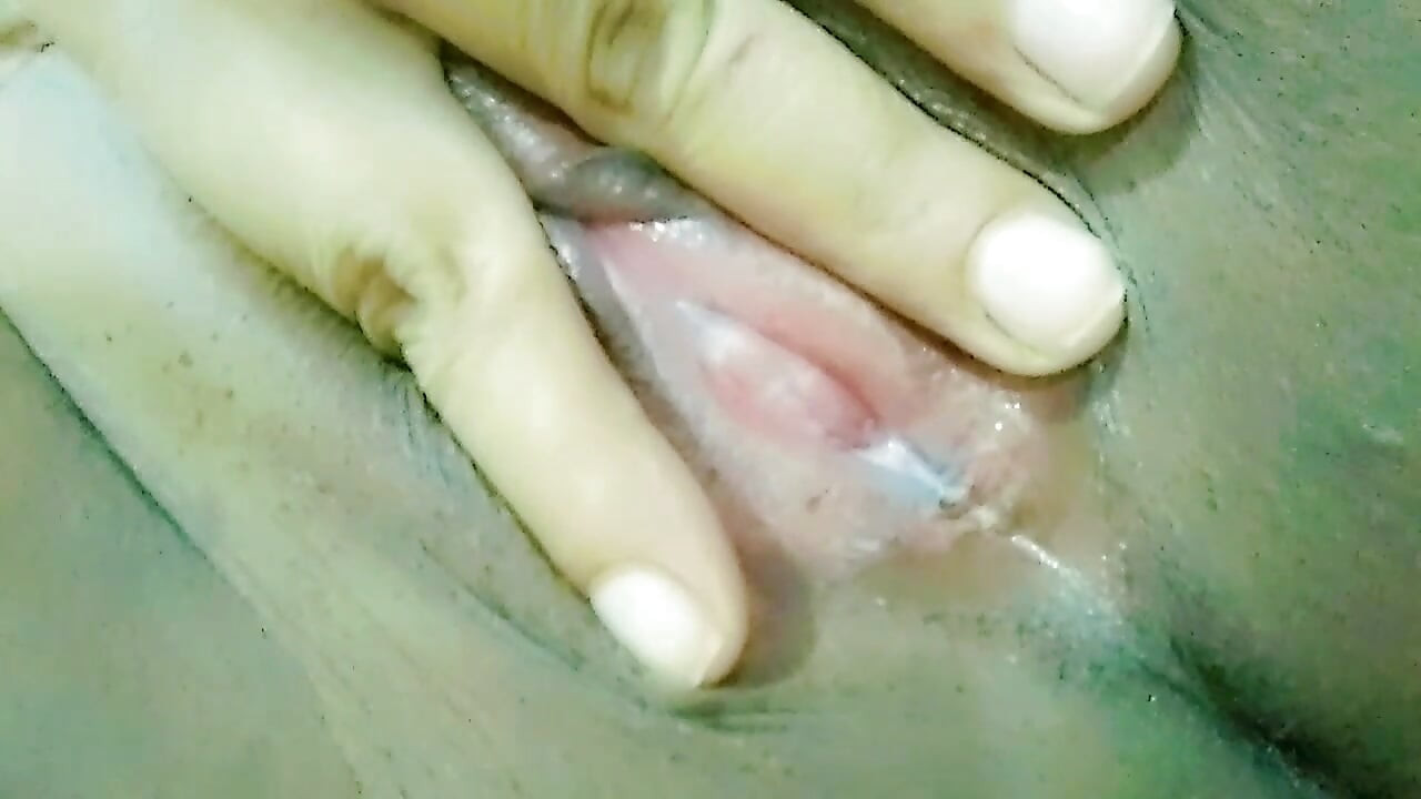 Choot ke chhed se saphed discharj