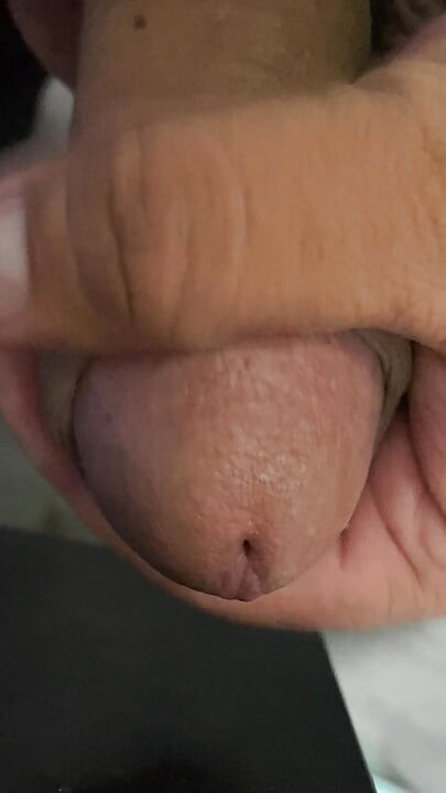 A lump of leftover flesh is growing in a rage, it must release the slime contained in it in the most drastic way
