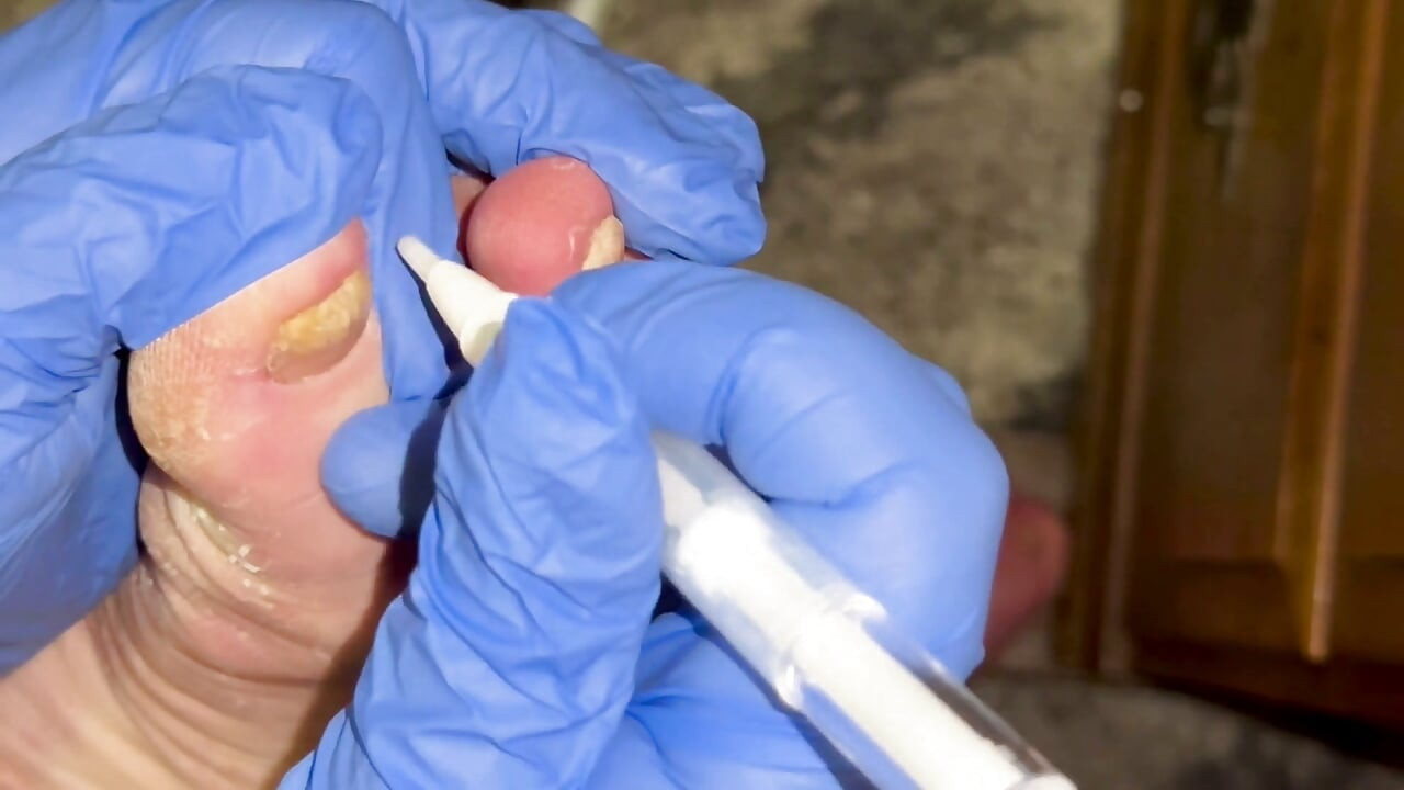Crusty Foot Care and Worship - FTM