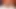 I'm a unique dwarf, I have two penises