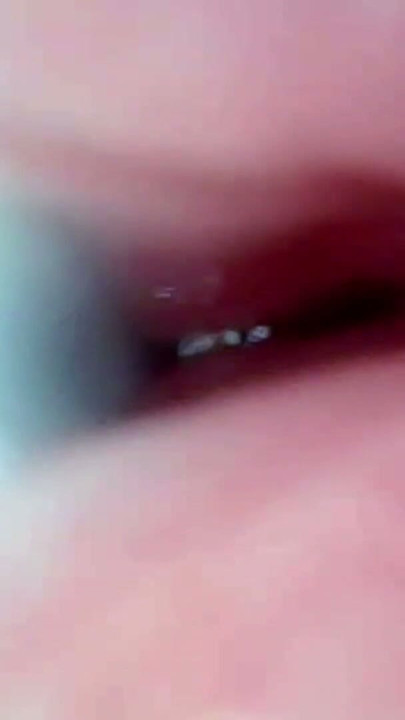 The camera in the penis shows the best picture of the male orgasm event | Clip 1