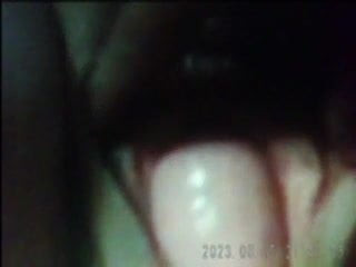 Big Mature Cervix! Amateur!