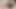 Clit Orgasm