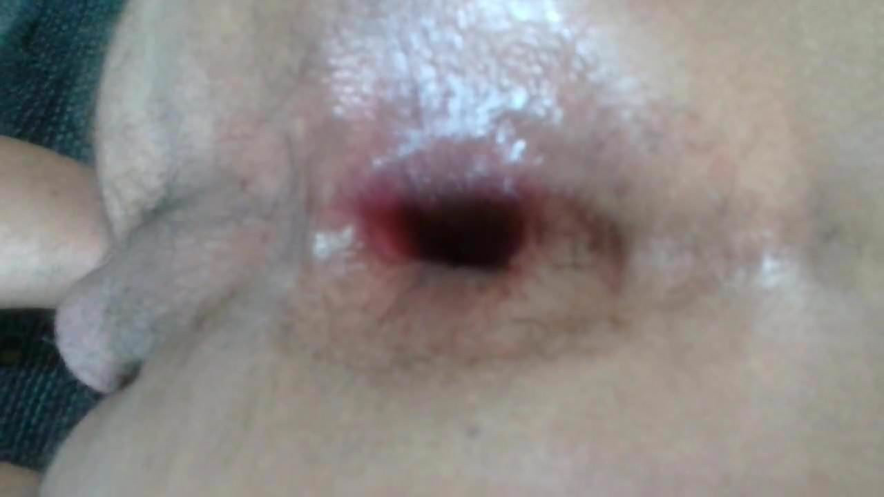 甘いぽっかりと開いた穴