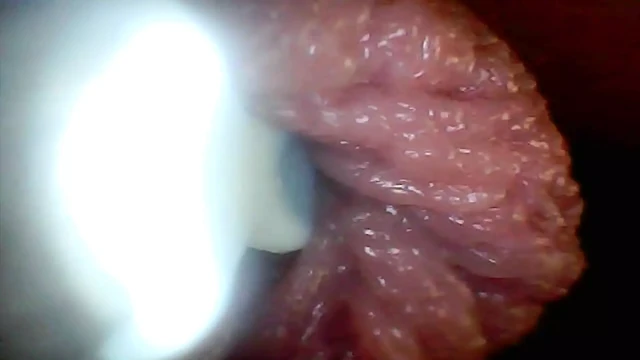 Endoscope Camera Shows the Most Sensitive Parts of the Penis Educational Video
