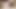 Hot Deep Prostate Massage And Huge Cumshot! Close-Up!