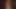 Jacinda Barrett, Nicole Kidman - человеческое пятно