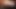 Big penis enlargement 5mints sex for not passs sex hot new for me to get the channel of communication accounts