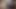 Hairy girl screaming while assfucked