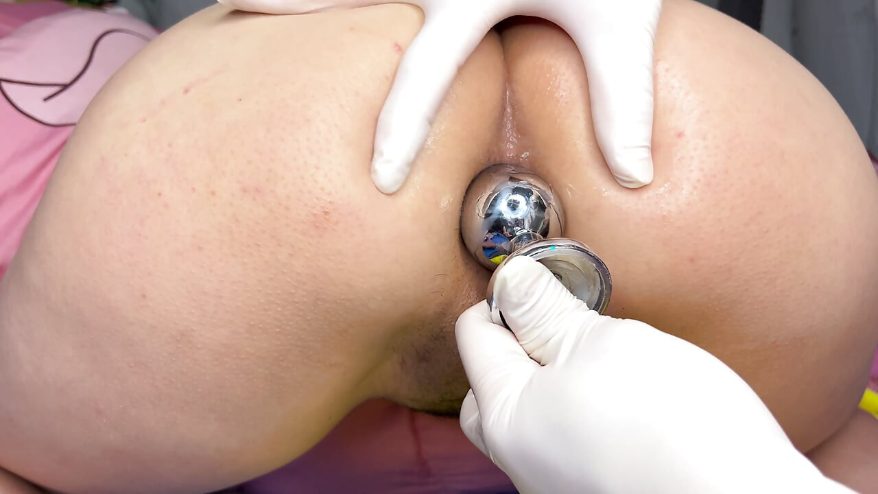 Ampliar el ano de mi esposa a 4 cm