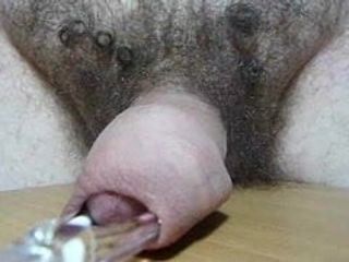 Penisimin sünnet derisinin altındaki çeşitli nesneler (1)
