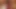 unknown german girl with broken leg masturbating on bed