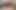 Miaxxx BBC Anal
