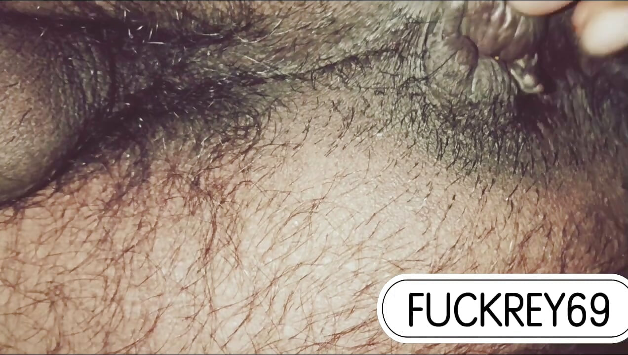 누구 내 엉덩이 가려움 좀 풀어줄 사람 없나 친구야 진짜 하고 싶다