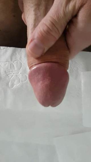 Abspritzen