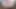 Close-Up, Pink Asshole and Uncut Cock