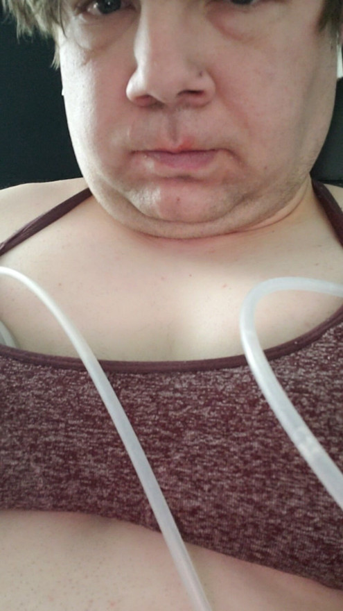 Lactation