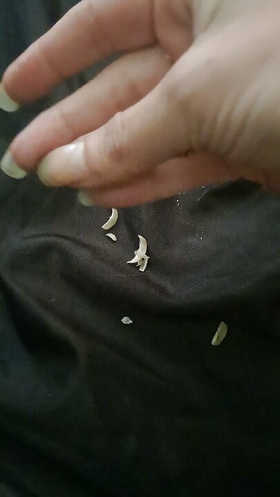 Long Toenail Clipping