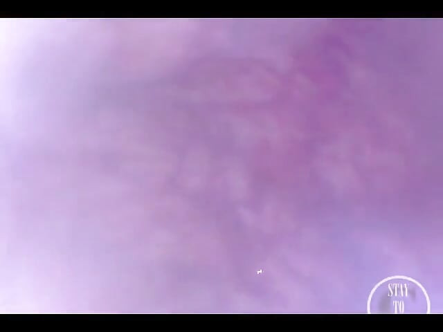 POV Ekstremni Duboki Analni Pregled!