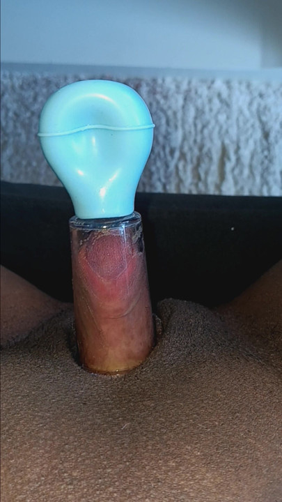 大基茨勒