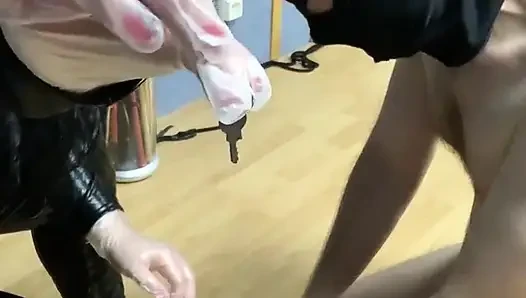 Entfernung des JOI&cei-Käfigs