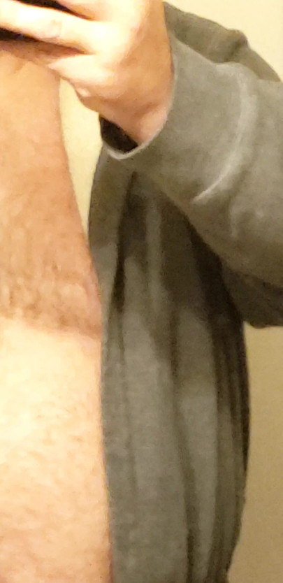 Frontal with chest and belly rub