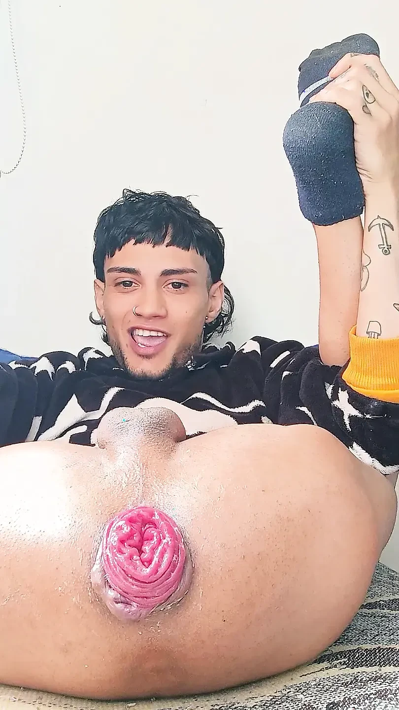 My Prolapse