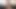 Guy with Cerebral Palsy has a Horny Big Dick with a Massive Cum Shot