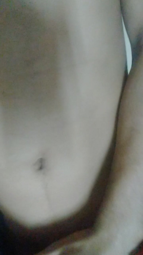 Fuck outdoor with family doctor