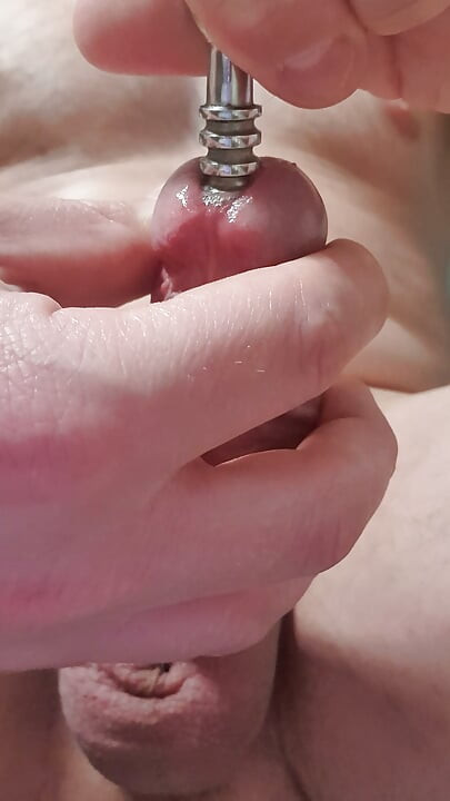 Extremely stretched hole after dilator play
