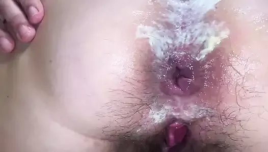 Fisting anal. Gaping asshole & Anal Stretching. Hairy pussy.