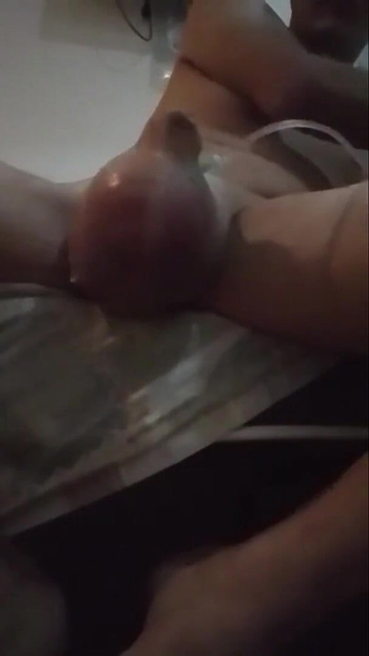 Key moment from "My journey of having 2L of D5NS turn my sac into a hot air balloon  (part1)"