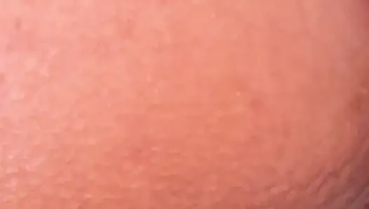 Götüme büyük tuzak