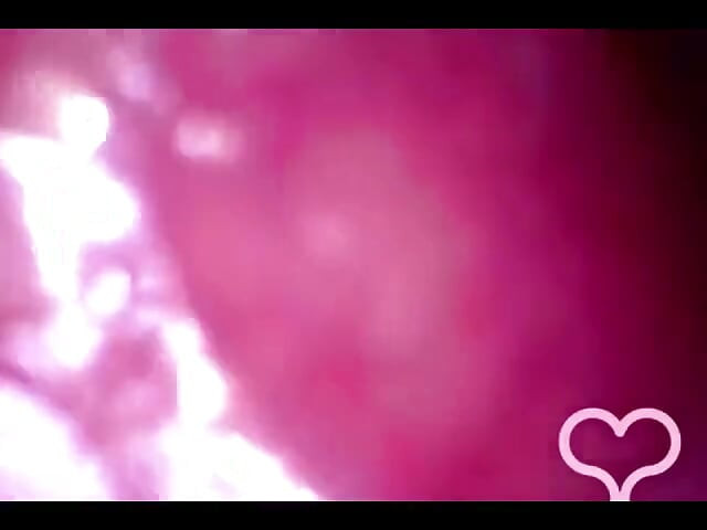 Analni endoskop sve do mog poprečnog debelog crijeva!