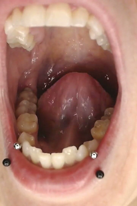 Climb Inside Wide Open Teeth Tongue Mouth Show