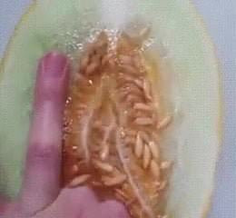 Vagina