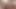 Teenmegaworld - güzellik melekleri - stresin yapay penis tedavileri