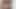 LizzyYum January 2024 ANAL DILATING #2 Post Op Orgasm Pussy anal Masturbation Teasing