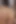 Postanede Arjantin'de viral anal