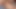 赤毛赤首女のボンデージセックス