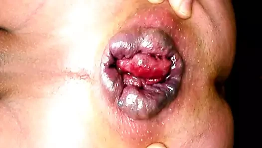 Gape
