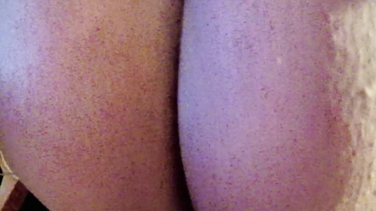 Exame Anal do rudeboiii