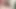 Trans Cock Erection 19