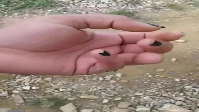missing finger