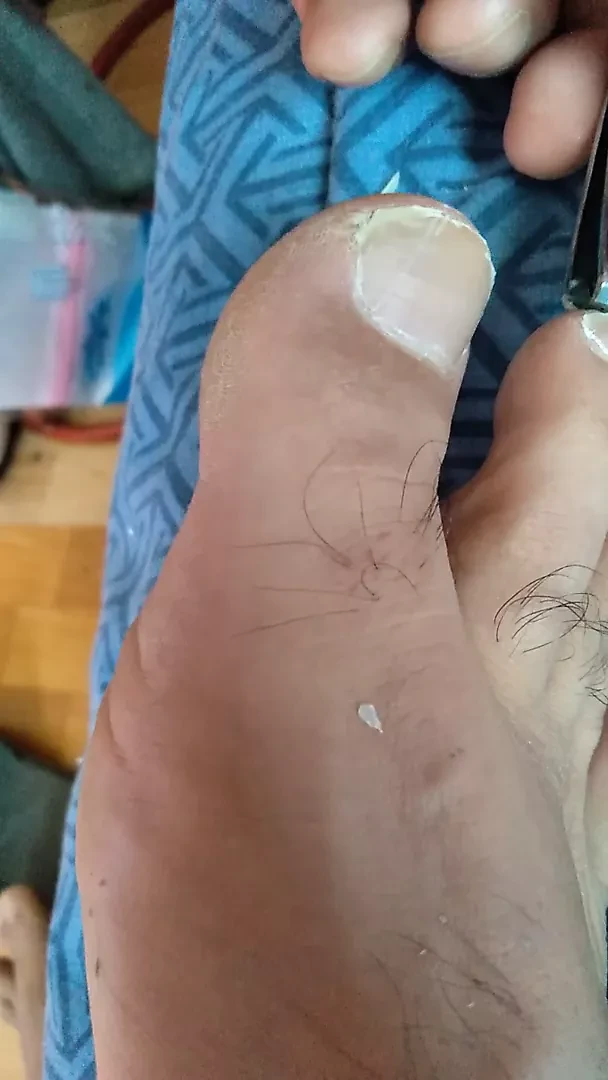 Trimming my toenails