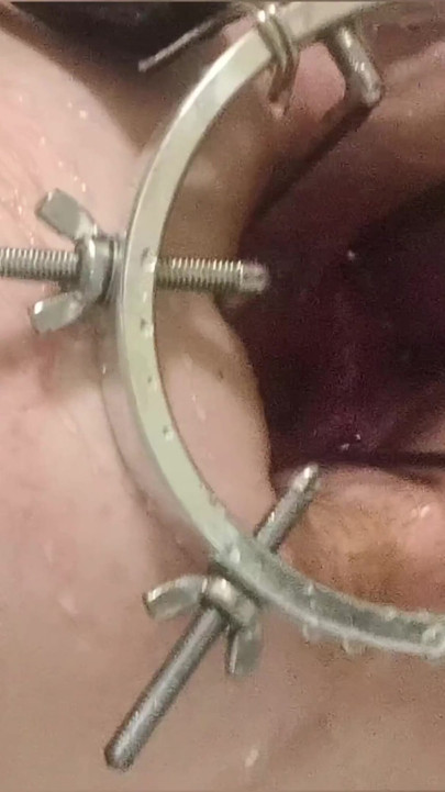 Enema, anal shower. Close-up view through anal mirror. Anal with water. Filling anal with water | Clip 2