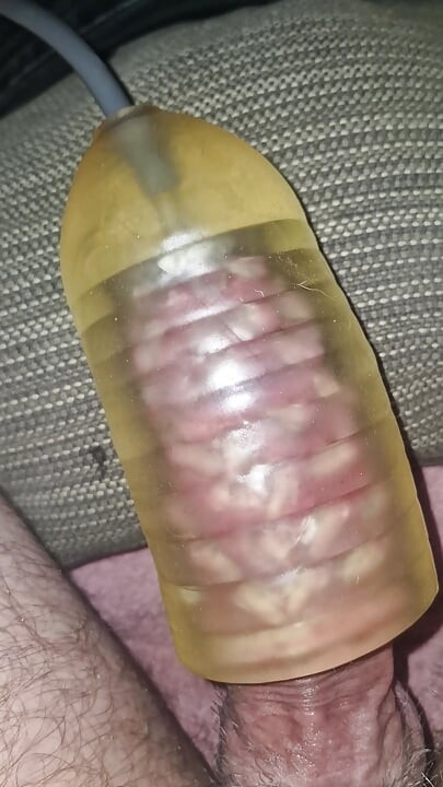 빨기