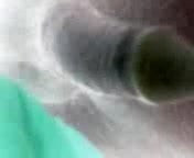jacking mine