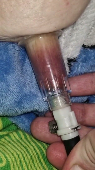 Nipple Suction Pumping . We're playing with my nipple . | Clip 2