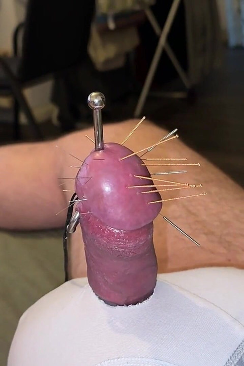 Acupuncture - Orgasm!